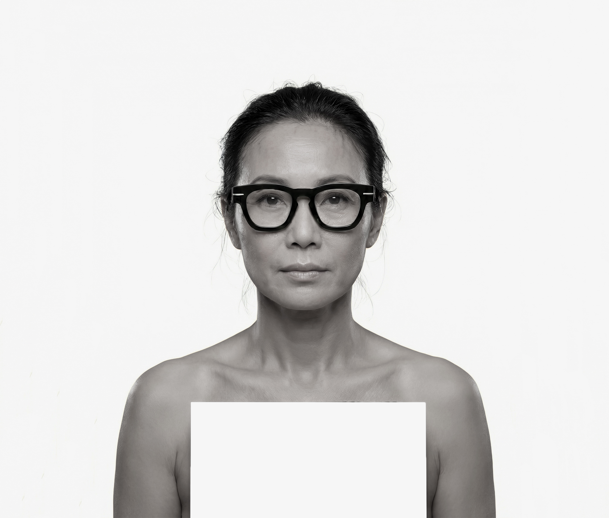 Acetate Collection